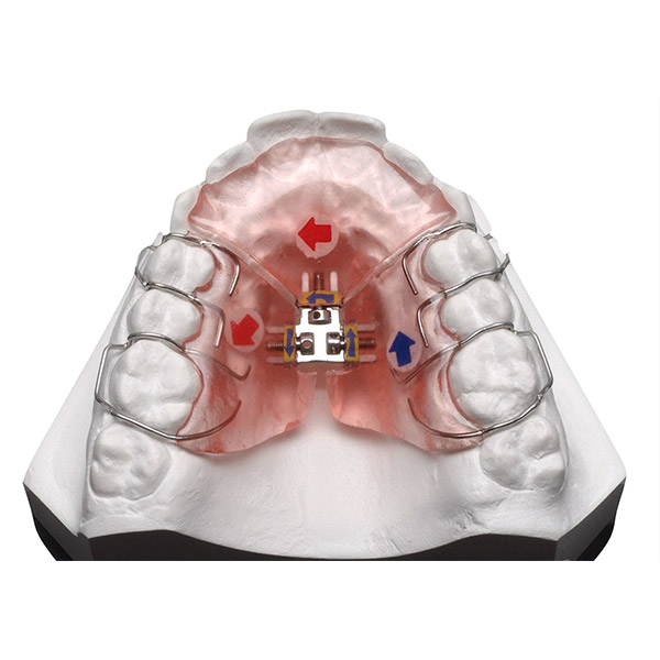 3 WAY Palatal Expander