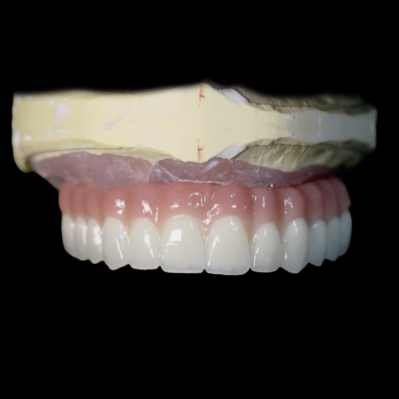 Hybrid implant dental